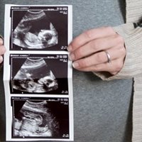 https://connect.bcbsnm.com/cfs-file/__key/communityserver-blogs-components-weblogfiles/00-00-00-00-02/PregnancyBabyUltrasound.jpg